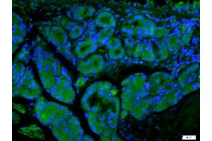 Paraformaldehyde-fixed, paraffin embedded Mouse esophagus, Antigen retrieval by boiling in sodium citrate buffer (pH6) for 15min, Block endogenous peroxidase by 3% hydrogen peroxide for 20 minutes, Blocking buffer (normal goat serum) at 37°C for 30min, Antibody incubation with ECM1 Polyclonal Antibody, Unconjugated  at 1:400 overnight at 4°C, followed by a FITC conjugated secondary antibody for 90minutes at 37°C and DAPI for nuclei staining. (ECM1 antibody  (AA 488-567))
