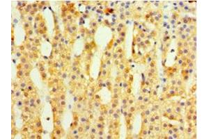 Immunohistochemistry of paraffin-embedded human adrenal gland tissue using ABIN7142344 at dilution of 1:100 (MRPL1 antibody  (AA 51-324))