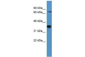 Western Blotting (WB) image for anti-SH3-Domain Binding Protein 5 (SH3BP5) (C-Term) antibody (ABIN2788422) (SH3BP5 antibody  (C-Term))