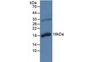 Detection of KLK2 in Rat Prostate Gland Tissue using Polyclonal Antibody to Kallikrein 2 (KLK2) (Kallikrein 2 antibody  (AA 19-261))