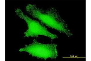 Immunofluorescence of monoclonal antibody to FOXO1 on HeLa cell. (FOXO1 antibody  (AA 556-655))