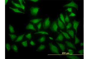 Immunofluorescence of monoclonal antibody to ARF5 on HeLa cell. (ARF5 antibody  (AA 81-180))