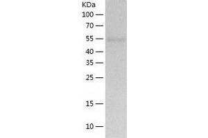 TBC1D22B Protein (AA 1-505) (His tag)