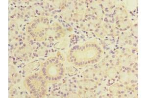 Immunohistochemistry of paraffin-embedded human pancreatic tissue using ABIN7171662 at dilution of 1:100 (TBC1D9B antibody  (AA 724-1023))