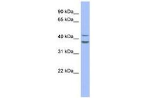 Image no. 1 for anti-Plasminogen Activator Inhibitor 2 (SERPINB2) (AA 179-228) antibody (ABIN6744064) (SERPINB2 antibody  (AA 179-228))