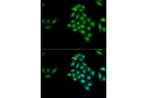 Immunofluorescence analysis of MCF7 cells using KLK10 antibody (ABIN6142943). (Kallikrein 10 antibody  (AA 35-276))