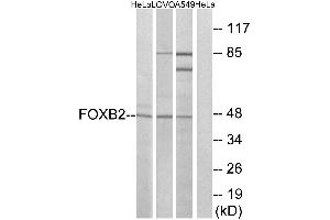 Western blot analysis of extracts from HeLa cells, LOVO cells and A549 cells, using FOXB2 antibody. (FOXB2 antibody  (Internal Region))