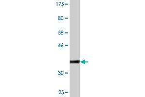 Western Blot detection against Immunogen (37. (MAP3K7 antibody  (AA 471-579))