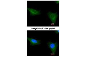 ICC/IF Image Immunofluorescence analysis of paraformaldehyde-fixed HeLa, using TTLL1, antibody at 1:200 dilution. (TTLL1 antibody)