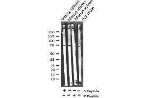 Western blot analysis of Phospho-Merlin (Ser518) expression in various lysates (Merlin antibody  (pSer518))