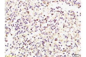 Formalin-fixed and paraffin embedded human spleen labeled with Anti-CXCL9/MIG Polyclonal Antibody, Unconjugated  at 1:200 followed by conjugation to the secondary antibody and DAB staining. (CXCL9 antibody  (AA 23-125))