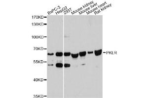 Western blot analysis of extracts of various cell lines, using PKLR antibody. (PKLR antibody)