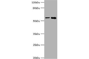 Western blot All lanes: IL1R1 antibody at 6 μg/mL Lane 1: Hela whole cell lysate Lane 2: Mouse heart tissue Secondary Goat polyclonal to rabbit IgG at 1/10000 dilution Predicted band size: 65 kDa Observed band size: 65 kDa (IL1R1 antibody  (AA 18-320))