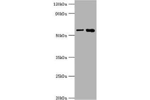 Western blot All lanes: IL1R1 antibody at 6 μg/mL Lane 1: Hela whole cell lysate Lane 2: Mouse heart tissue Secondary Goat polyclonal to rabbit IgG at 1/10000 dilution Predicted band size: 65 kDa Observed band size: 65 kDa (IL1R1 antibody  (AA 18-320))