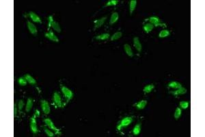 Immunofluorescent analysis of Hela cells using ABIN7143166 at dilution of 1:100 and Alexa Fluor 488-congugated AffiniPure Goat Anti-Rabbit IgG(H+L) (Activator of Basal Transcription 1 antibody  (AA 197-270))