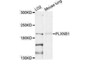 Western blot analysis of extracts of LO2 and mouse lung cells, using PLXNB1 antibody. (PLXNB1 antibody)