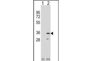 Western blot analysis of R (arrow) using rabbit polyclonal R Antibody (N-term) (ABIN653060 and ABIN2842661). (RPA2 antibody  (N-Term))