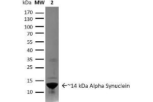 SNCA Protein (full length)