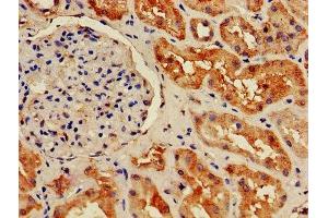 Immunohistochemistry (IHC) image for anti-Histone Cluster 1, H2bb (HIST1H2BB) (AA 2-126) antibody (ABIN7155391)