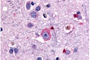 Anti-GRM1 / MGLUR1 antibody  ABIN1048925 IHC staining of human brain, neurons and glia. (Metabotropic Glutamate Receptor 1 antibody  (N-Term))