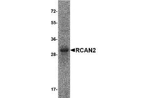 Western Blotting (WB) image for Regulator of Calcineurin 2 (RCAN2) (AA 2-197), (Isoform 2) protein (His tag) (ABIN2469007)