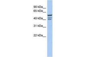 Image no. 1 for anti-Zinc Finger Protein 140 (ZNF140) (C-Term) antibody (ABIN6742762) (ZNF140 antibody  (C-Term))