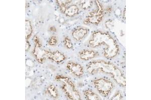 Immunohistochemical staining of human kidney with SPOCD1 polyclonal antibody  shows moderate luminal membrane positivity in cells of tubules at 1:50-1:200 dilution. (SPOCD1 antibody)