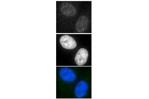 Immunofluorescence (IF) image for anti-DNA Repair Protein Homolog 1 (RAD51) antibody (ABIN2452093) (RAD51 antibody)