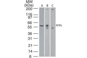 Image no. 1 for anti-RAR-Related Orphan Receptor C (RORC) (AA 1-50) antibody (ABIN959913) (RORC antibody  (AA 1-50))