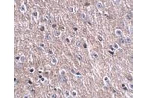 Immunohistochemistry of FNIP2 in mouse brain tissue with FNIP2 antibody at 2. (CDIP1 antibody  (Center))