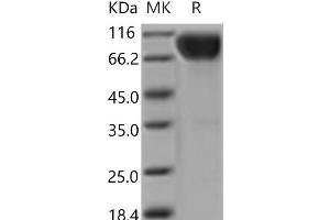Western Blotting (WB) image for Interleukin 17 Receptor A (IL17RA) (Active) protein (Fc Tag) (ABIN7196415) (IL17RA Protein (Fc Tag))