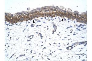 ZNF385 antibody was used for immunohistochemistry at a concentration of 4-8 ug/ml to stain Epidermal cells (arrows) in Human Skin. (ZNF385A antibody  (C-Term))