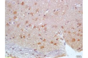 Formalin-fixed and paraffin embedded rat brain labeled with Anti-Calbindin/Calbindin D28k Polyclonal Antibody, Unconjugated (ABIN703691) at 1:200 followed by conjugation to the secondary antibody and DAB staining (CALB1 antibody)