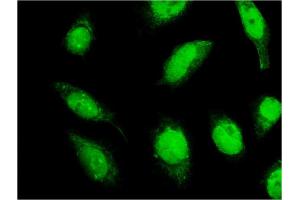 Immunofluorescence of monoclonal antibody to C18orf23 on HeLa cell. (C18orf23 antibody  (AA 122-220))