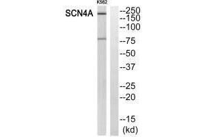 Western blot analysis of extracts from K562 cells, using SCN4A antibody. (SCN4A antibody)