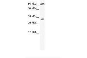 Image no. 1 for anti-Poly (ADP-Ribose) Polymerase Family, Member 16 (PARP16) (AA 35-84) antibody (ABIN6736021) (PARP16 antibody  (AA 35-84))