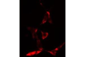 ABIN6275675 staining CoLo cells by IF/ICC.