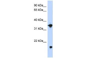 Western Blotting (WB) image for anti-Glycerol-3-Phosphate Dehydrogenase 1 (Soluble) (GPD1) antibody (ABIN2458633) (GPD1 antibody)