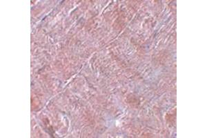 Immunohistochemistry staining in human skeletal muscle tissue with RANBP10 Antibody  at 5 μg/ml. (RANBP10 antibody  (Center))