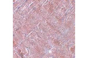 Immunohistochemistry staining in human skeletal muscle tissue with RANBP10 Antibody  at 5 μg/ml.
