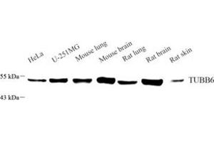 Western blot analysis of TUBB6 (ABIN7076054) at dilution of 1: 3000 (TUBb6 antibody)