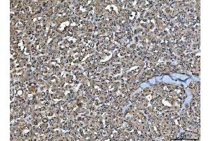 IHC analysis of HMGCR using anti-HMGCR antibody (ABIN7600989).