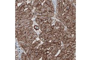 Immunohistochemical staining (Formalin-fixed paraffin-embedded sections) of human heart with LAMB2 monoclonal antibody, clone CL2976  shows strong membranous immunoreactivity in cardiomyocytes.
