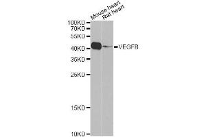 Western blot analysis of extracts of various cell lines, using VEGFB Antibody (ABIN5971159) at 1/1000 dilution. (VEGFB antibody)