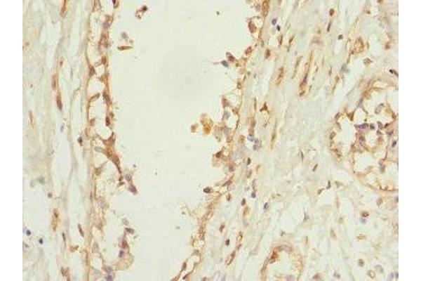 PLEKHF2 antibody  (AA 1-249)