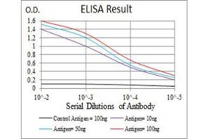 Black line: Control Antigen (100 ng), Purple line: Antigen(10 ng), Blue line: Antigen (50 ng), Red line: Antigen (100 ng), (KBTBD8 antibody  (AA 264-464))