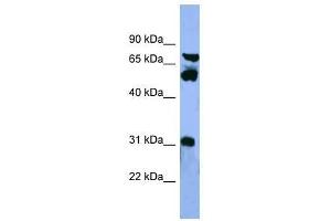 Western Blot showing CYP8B1 antibody used at a concentration of 1-2 ug/ml to detect its target protein. (CYP8B1 antibody  (Middle Region))