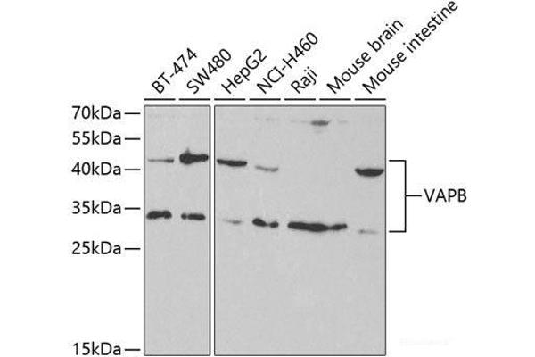 VAPB anticorps