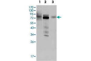 Western blot analysis using MDM4 monoclonal antobody, clone 2D10F4  against HeLa (1), A-549 (2) and A-431 (3) cell lysate.