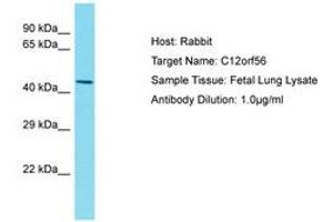 Image no. 1 for anti-Chromosome 12 Open Reading Frame 56 (C12ORF56) (AA 77-126) antibody (ABIN6750551) (C12orf56 antibody  (AA 77-126))